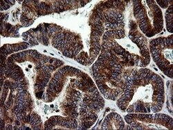 MAPK9 Monoclonal Antibody (OTI2H3), TrueMAB , OriGene 100 &mu;L; Unconjugated:Antibodies,