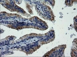 MAPK9 Monoclonal Antibody (OTI2H3), TrueMAB , OriGene 100 &mu;L; Unconjugated:Antibodies,