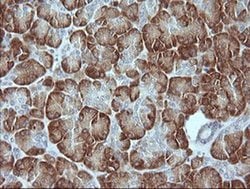 MAPK9 Monoclonal Antibody (OTI4D1), TrueMAB , OriGene 100 &mu;L; Unconjugated:Antibodies,