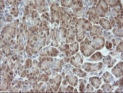 MAPK9 Monoclonal Antibody (OTI1A1), TrueMAB , OriGene 100 &mu;L; Unconjugated:Antibodies,