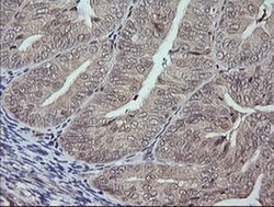 MAPK9 Monoclonal Antibody (OTI1A1), TrueMAB , OriGene 100 &mu;L; Unconjugated:Antibodies,