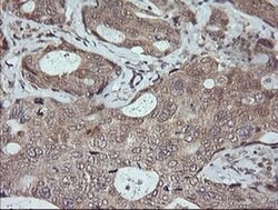 MAPK9 Monoclonal Antibody (OTI1A1), TrueMAB , OriGene:Antibodies:Primary