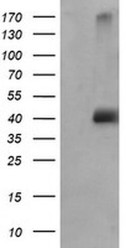 MAPK9 Monoclonal Antibody (OTI2H3), TrueMAB , OriGene 100 &mu;L; Unconjugated:Antibodies,