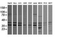 MAPK9 Mouse anti-Canine, Human, Mouse, Rat, Clone: OTI2D11, lyophilized,