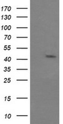 MAPK9 Monoclonal Antibody (OTI1A1), TrueMAB , OriGene 100 &mu;L; Unconjugated:Antibodies,