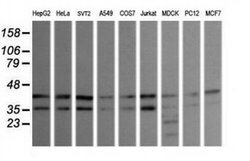 MAPK9 Monoclonal Antibody (OTI1A1), TrueMAB , OriGene 100 &mu;L; Unconjugated:Antibodies,