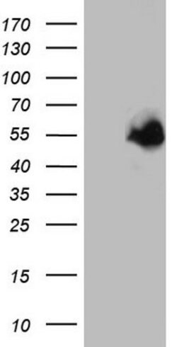 MAPKAPK5 Mouse anti-Human, Clone: OTI1B4, lyophilized, TrueMAB 100 &mu;g;