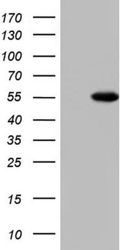 MAPKAPK5 Monoclonal Antibody (OTI1A12), TrueMAB , OriGene 100 &mu;L | Buy Online | Origene Technologies | Fisher Scientific