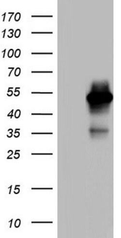 MAPKAPK5 Mouse anti-Human, Clone: OTI1D11, lyophilized, TrueMAB 100 &mu;g;