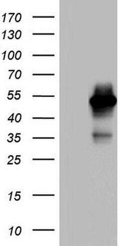 MAPKAPK5 Monoclonal Antibody (OTI1D11), TrueMAB , OriGene 100 &mu;L | Buy Online | OriGene | Fisher Scientific