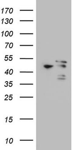 MAPKAPK5 Monoclonal Antibody (OTI1B3), TrueMAB , OriGene 100 &mu;L; Unconjugated:Antibodies,