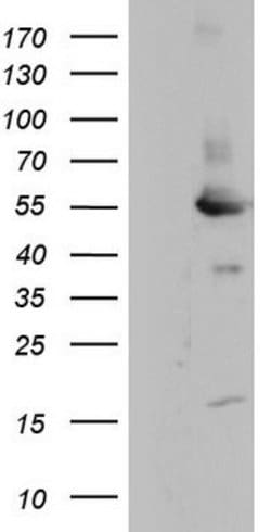 MAPKAPK5 Mouse anti-Human, Clone: OTI1A7, lyophilized, TrueMAB 100 &mu;g;