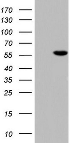 MAPKAPK5 Mouse anti-Human, Clone: OTI1F5, lyophilized, TrueMAB 100 &mu;g;