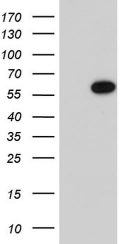 MAPKAPK5 Monoclonal Antibody (OTI4H4), TrueMAB , OriGene 100 &mu;L; Unconjugated:Antibodies,