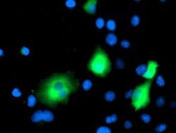 EB2 (MAPRE2) Monoclonal Antibody (OTI7C10), TrueMAB , OriGene 30 &mu;L;