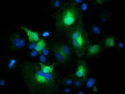 EB2 (MAPRE2) Monoclonal Antibody (OTI4G1), TrueMAB , OriGene 30 &mu;L;