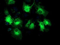 EB2 (MAPRE2) Monoclonal Antibody (OTI5F3), TrueMAB , OriGene 30 &mu;L;