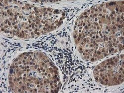 MAPRE2 Mouse anti-Human, Clone: OTI1F3, lyophilized, TrueMAB 100 &mu;g;