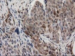 MAPRE2 Mouse anti-Human, Clone: OTI1F3, lyophilized, TrueMAB 100 &mu;g;