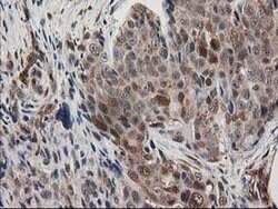 EB2 (MAPRE2) Monoclonal Antibody (OTI1F3), TrueMAB , OriGene 100 &mu;L;