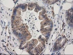 MAPRE2 Mouse anti-Human, Clone: OTI1F3, lyophilized, TrueMAB 100 &mu;g;