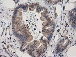 EB2 (MAPRE2) Monoclonal Antibody (OTI1F3), TrueMAB , OriGene 100 &mu;L;