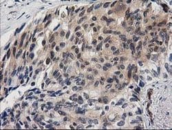 EB2 (MAPRE2) Monoclonal Antibody (OTI1D10), TrueMAB , OriGene 30 &mu;L;