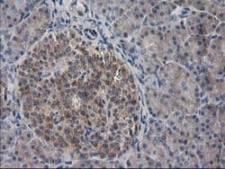 EB2 (MAPRE2) Monoclonal Antibody (OTI1D10), TrueMAB , OriGene 30 &mu;L;