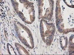 EB2 (MAPRE2) Monoclonal Antibody (OTI1D10), TrueMAB , OriGene 30 &mu;L;