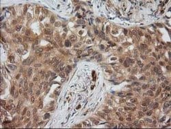 EB2 (MAPRE2) Monoclonal Antibody (OTI5F3), TrueMAB , OriGene 30 &mu;L;