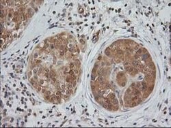EB2 (MAPRE2) Monoclonal Antibody (OTI5F3), TrueMAB , OriGene 30 &mu;L;