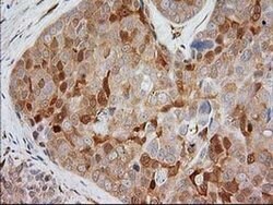 EB2 (MAPRE2) Monoclonal Antibody (OTI5F3), TrueMAB , OriGene 30 &mu;L;