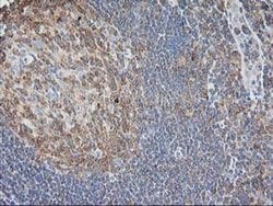 EB2 (MAPRE2) Monoclonal Antibody (OTI5F3), TrueMAB , OriGene:Antibodies:Primary