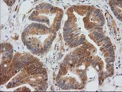 EB2 (MAPRE2) Monoclonal Antibody (OTI5F3), TrueMAB , OriGene 30 &mu;L;