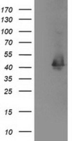 MAPRE2 Mouse anti-Human, Clone: OTI1F3, lyophilized, TrueMAB 100 &mu;g;