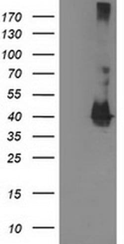 EB2 (MAPRE2) Monoclonal Antibody (OTI1D10), TrueMAB , OriGene 30 &mu;L;