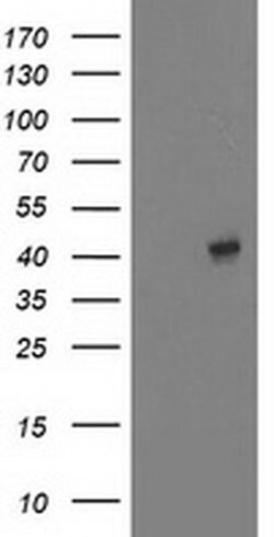 EB2 (MAPRE2) Monoclonal Antibody (OTI7C10), TrueMAB , OriGene 30 &mu;L;