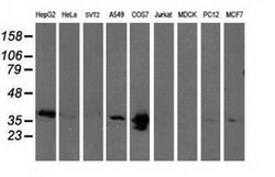 EB2 (MAPRE2) Monoclonal Antibody (OTI7C10), TrueMAB , OriGene 30 &mu;L;
