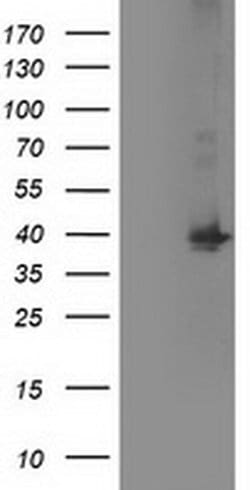 MAPRE2 Monoclonal Antibody (OTI3C4), TrueMAB , OriGene:Antibodies:Primary