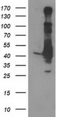EB2 (MAPRE2) Monoclonal Antibody (OTI4G1), TrueMAB , OriGene 30 &mu;L;