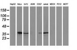 EB2 (MAPRE2) Monoclonal Antibody (OTI4G1), TrueMAB , OriGene:Antibodies:Primary