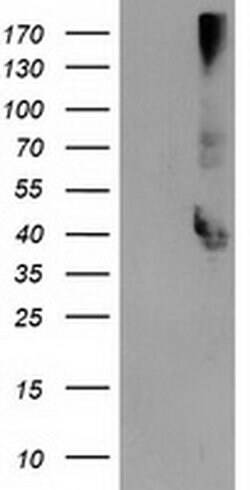 EB2 (MAPRE2) Monoclonal Antibody (OTI5F3), TrueMAB , OriGene 30 &mu;L;
