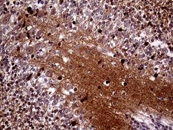 MAPT Monoclonal Antibody (OTI6G3), TrueMAB , OriGene 100 &mu;L; Unconjugated:Antibodies,