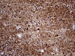 MAPT Mouse anti-Human, Clone: OTI13E11, lyophilized, TrueMAB 100 &mu;g | Buy Online | Origene Technologies | Fisher Scientific