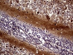 MAPT Mouse anti-Human, Clone: OTI13B5, lyophilized, TrueMAB 100 &mu;g;