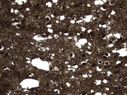 MAPT Mouse anti-Human, Clone: UMAB239, lyophilized, UltraMAB 100 &mu;g | Buy Online | Origene Technologies | Fisher Scientific