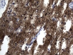 MAPT Mouse anti-Human, Clone: UMAB239, lyophilized, UltraMAB 100 &mu;g | Buy Online | Origene Technologies | Fisher Scientific