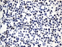 MAPT Mouse anti-Human, Clone: UMAB239, lyophilized, UltraMAB 100 &mu;g | Buy Online | Origene Technologies | Fisher Scientific