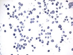 MAPT Mouse anti-Human, Clone: UMAB239, lyophilized, UltraMAB 100 &mu;g | Buy Online | Origene Technologies | Fisher Scientific