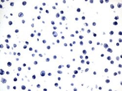 MAPT Mouse anti-Human, Clone: UMAB239, lyophilized, UltraMAB 100 &mu;g | Buy Online | Origene Technologies | Fisher Scientific